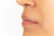 © Emir - Close-up of female lips on white background before lip augmentation.