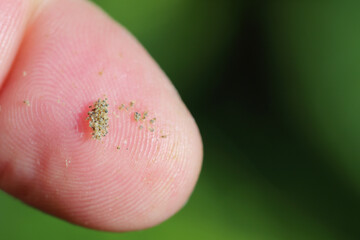 Wall Mural - Tetranychus urticae (red spider mite or two-spotted spider mite) is a species of plant-feeding mite a pest of many plants. Lots of spiders on finger.