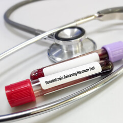 Poster - Gonadotropin releasing hormone (GnRH). Test tube with blood sample for Gonadotropin releasing hormone (GnRH) test. Stethoscope.