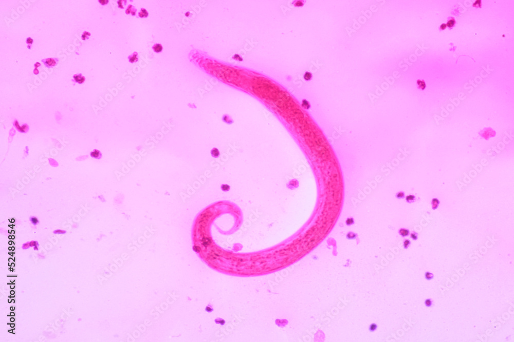 View in microscopic Strongyloides stercoralis or threadworm in human