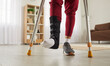 Man with broken leg or foot injury walking with crutches at home. Young guy wearing ankle support brace or fracture fixator with adjustable straps standing in living room. Cropped low section close up