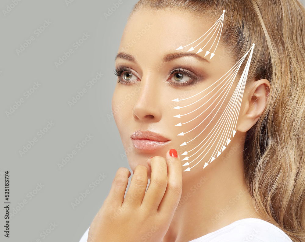 Markup Thread Foto Thread Lift ,markup, thread-lift procedure for facial rejuvenation ...