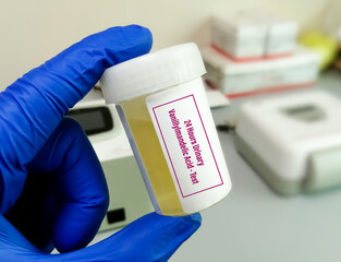 Canvas Print - Urine sample for VMA (Vanillylmandelic acid) Test,  used to detect neuroblastomas and neuroendocrine tumors.