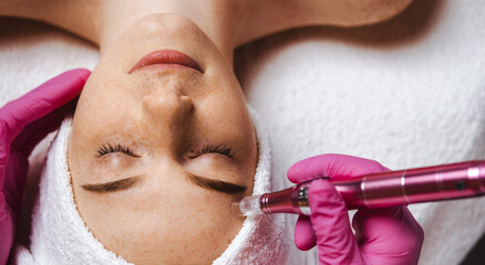 Wall Mural - close-up view of a woman receiving oxy derma therapy with derma pen in beauty spa salon. professiona