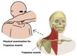 The physical examination of cranial nerve 11th via trapezius and sternocleidomastoid muscles power testing.