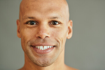 Close up of freckled African American man looking at camera.