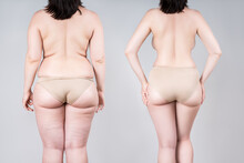 Woman's Body Before And After Weight Loss Or Liposuction On Gray Background, Fat And Thin Female Back And Buttocks