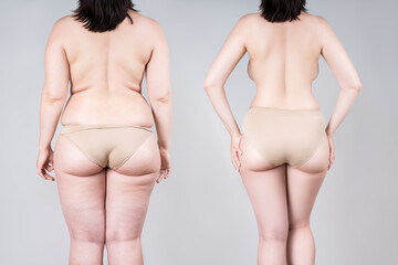 woman's body before and after weight loss or liposuction on gray background, fat and thin female bac