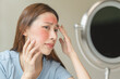 © Pormezz - Sensitive skin with cosmetology, Asian young woman looking at red spot on her face from cosmetic allergy in the mirror.