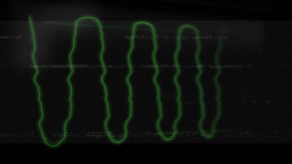 Poster - Animation of glowing green multiple waves with glitch on black screen in the background
