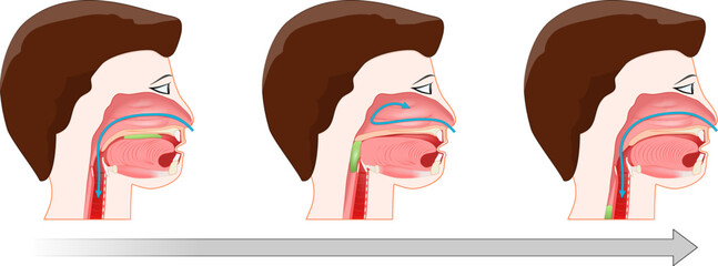 Swallowing. Process of deglutition.