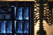 © SuperStock - Scans of human spinal cord