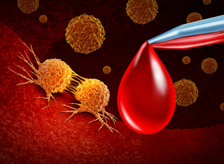 Wall Mural - cancer screening and blood test for early detection of malignant cells in a human body caused by car