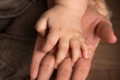 © natrocfort - Polydactyly baby hand genetic condition