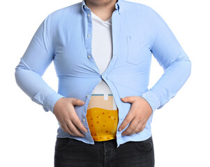 Wall Mural - Beer belly problem. Overweight man on white background, closeup