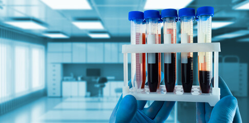Poster - genetic analysis. hands of geneticist with test tubes. blood to study patients dna. analysis of rna 