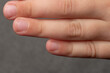 © Niko_Dali - Child's dirty and sloppily cut nails, fingers and toenails close-up.