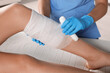 © New Africa - Doctor applying bandage onto patient's shin in hospital, closeup