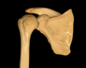 Poster - CT Shoulder 3D