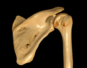 Poster - CT Shoulder 3D