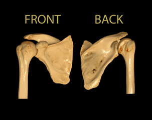Poster - CT Shoulder 3D