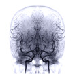 Cerebral angiography