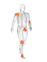 3d rendered medically accurate illustration of a walkers painful joints