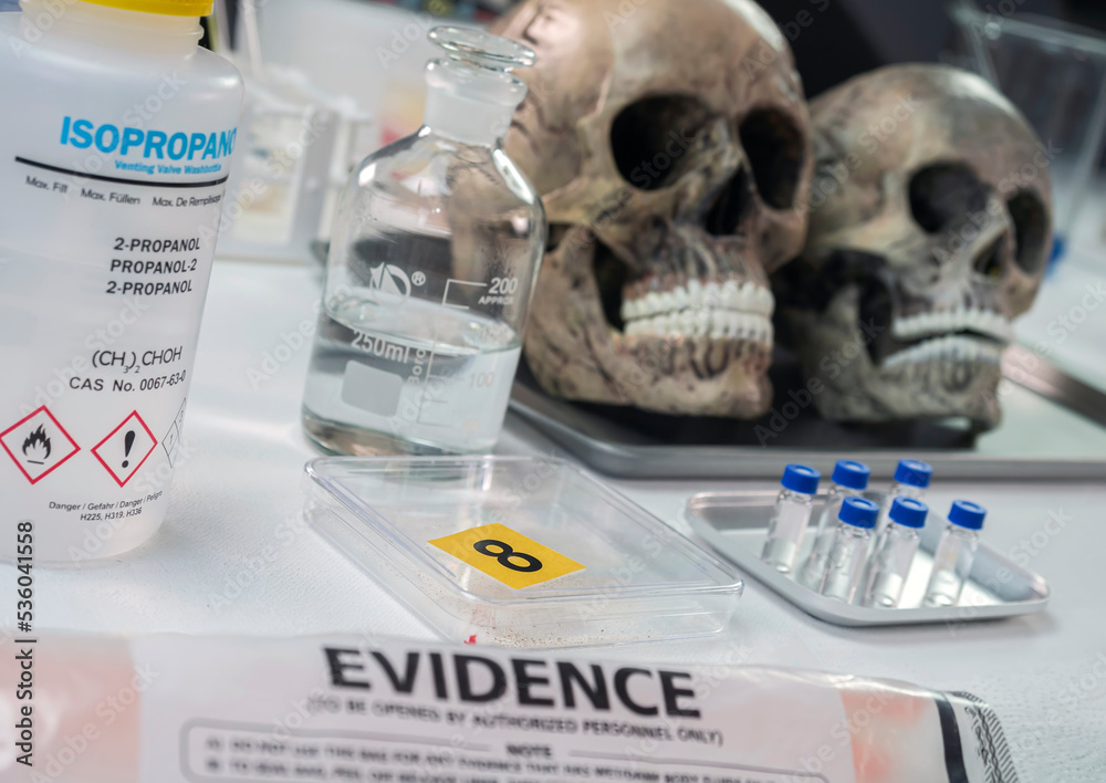 Human skull of a murdered adult in forensic lab, conceptual image Stock ...
