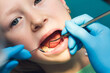 © Marina Varnava - a cute little girl sits in a dental chair with her mouth open while being examined by a doctor.