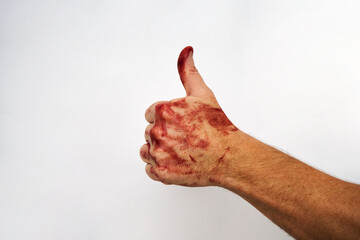 Fototapeta bloody hand showing thumb up, close-up