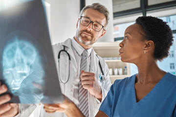 Wall Mural - Brain, x ray and neurology doctors in a meeting working on a skull injury in emergency room in a hospital. Diversity, cancer and healthcare medical neurologist checking mri or xray scan with teamwork