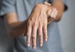 © ZAY WIN HTAI - Radial nerve injury or wrist drop