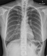 film x-ray woman chest