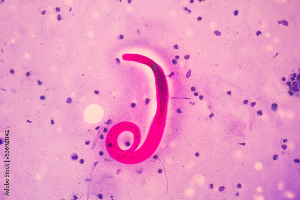 View in microscopic Strongyloides stercoralis or threadworm in human