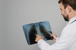 © ViDi Studio - Cropped male doctor man wear white medical gown suit work in hospital hold fluorography roentgen X-ray of lungs with pneumonia isolated on plain grey background studio . Healthcare medicine concept.