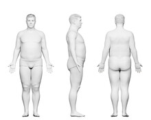 3d Rendered Medical Illustration Of A Potbellied Male Body