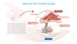 Parts of the pituitary gland, the cause of some diseases such as acromegaly.