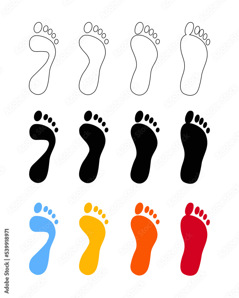 Deformation of the foot. Set of stages of flat feet. Foot icons ...