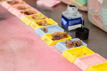 Cassettes with biopsy samples being processed at the pathology laboratory to be embedded in paraffin for analysis. Cancer diagnosis concept. Medical concept.