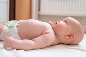 A mark on the baby's arm from BCG vaccination