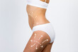 Cellulite removal on body girl. Young woman with beautiful and healthy body concept close up, sideways.