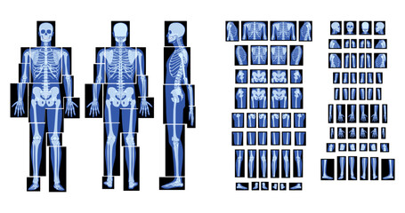 Set of X-Ray Skeleton Human body - hands, legs, chests, heads, vertebra, pelvis, Bones adult people roentgen front back side view. 3D realistic flat blue color Vector illustration of medical anatomy