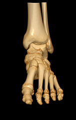 Poster - 3d rendering of the foot bones for diagnosis bone fracture and rheumatoid arthritis.