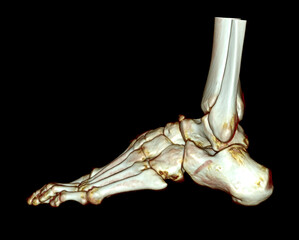 Poster - 3d rendering of the foot bones for diagnosis bone fracture and rheumatoid arthritis.