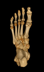 Poster - 3d rendering of the foot bones for diagnosis bone fracture and rheumatoid arthritis.