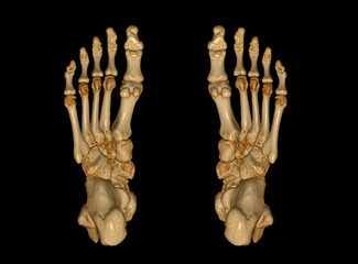 Poster - 3d rendering of the foot bones for diagnosis bone fracture and rheumatoid arthritis.