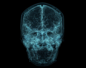 Sticker - Human Skull, Brain by CT Scan. X-ray Visualization Inside Of Skull. 3D Illustration Render