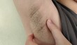 © Rung Kh - Portrait showing the fingers holding the flabbiness adipose and flabby skin under the arm, problem wrinkled and flabby skin, armpit hair underarm of the woman, concept health care and beauty.
