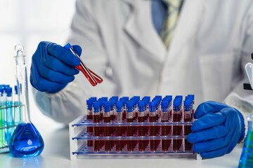 Vascular health doctor in clinical laboratory for medical research and development concepts. and science with a microscope and a test tube placed beside it