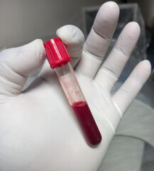 Canvas Print - Hand of a doctor holding a test tube of blood. close up view.